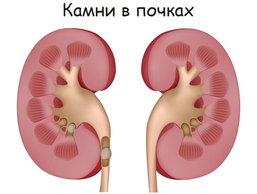 Кракен топ